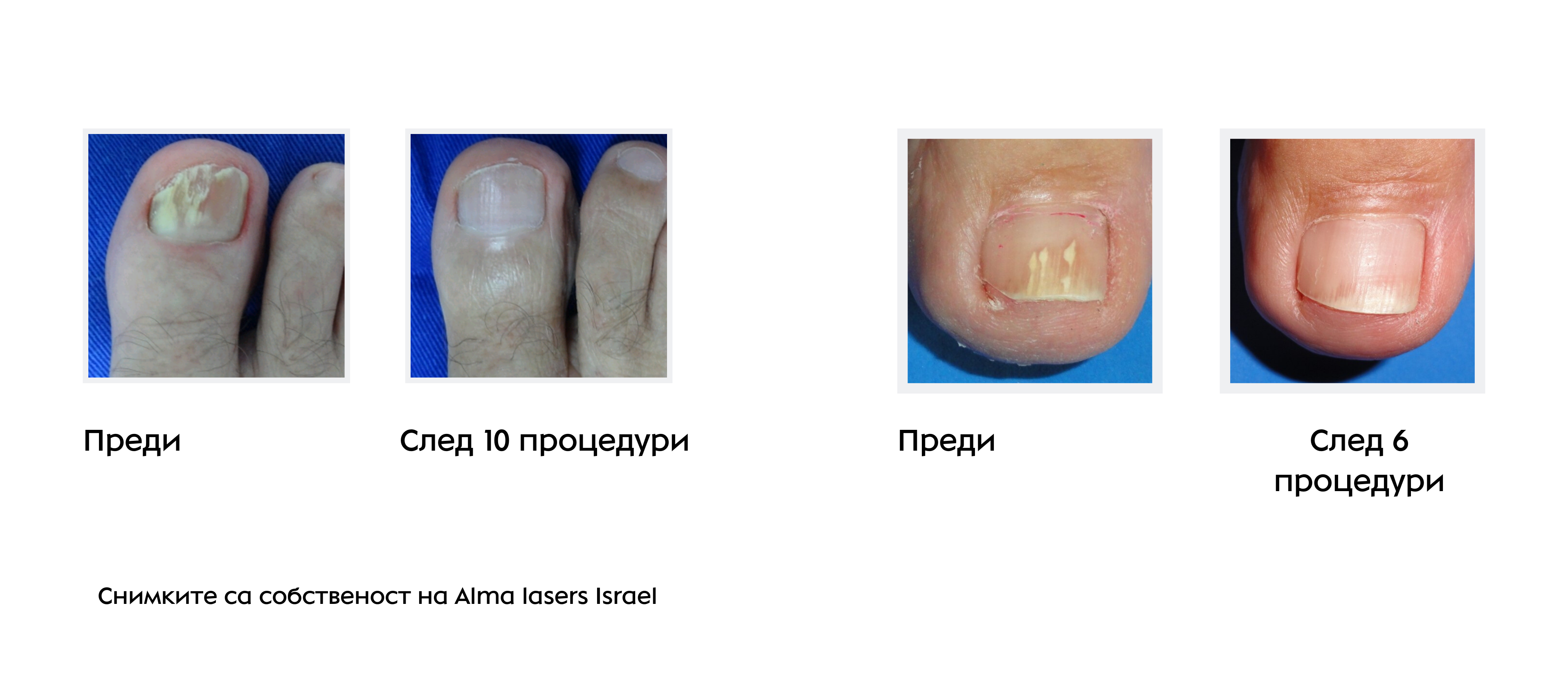 Решетка